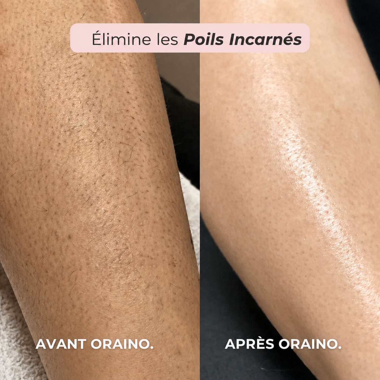 Rasoir 2-en-1 bikini et corps Oraino™