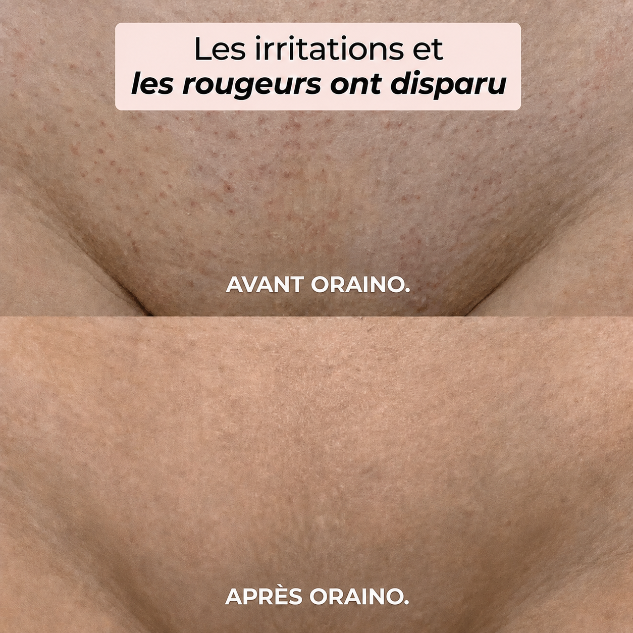 Rasoir 2-en-1 bikini et corps Oraino™