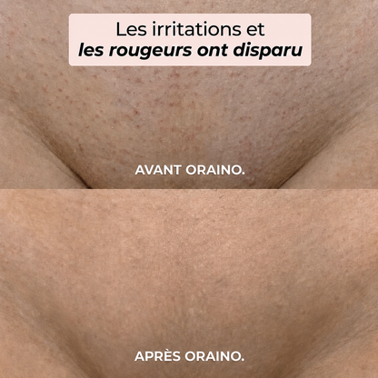 Rasoir 2-en-1 bikini et corps Oraino™