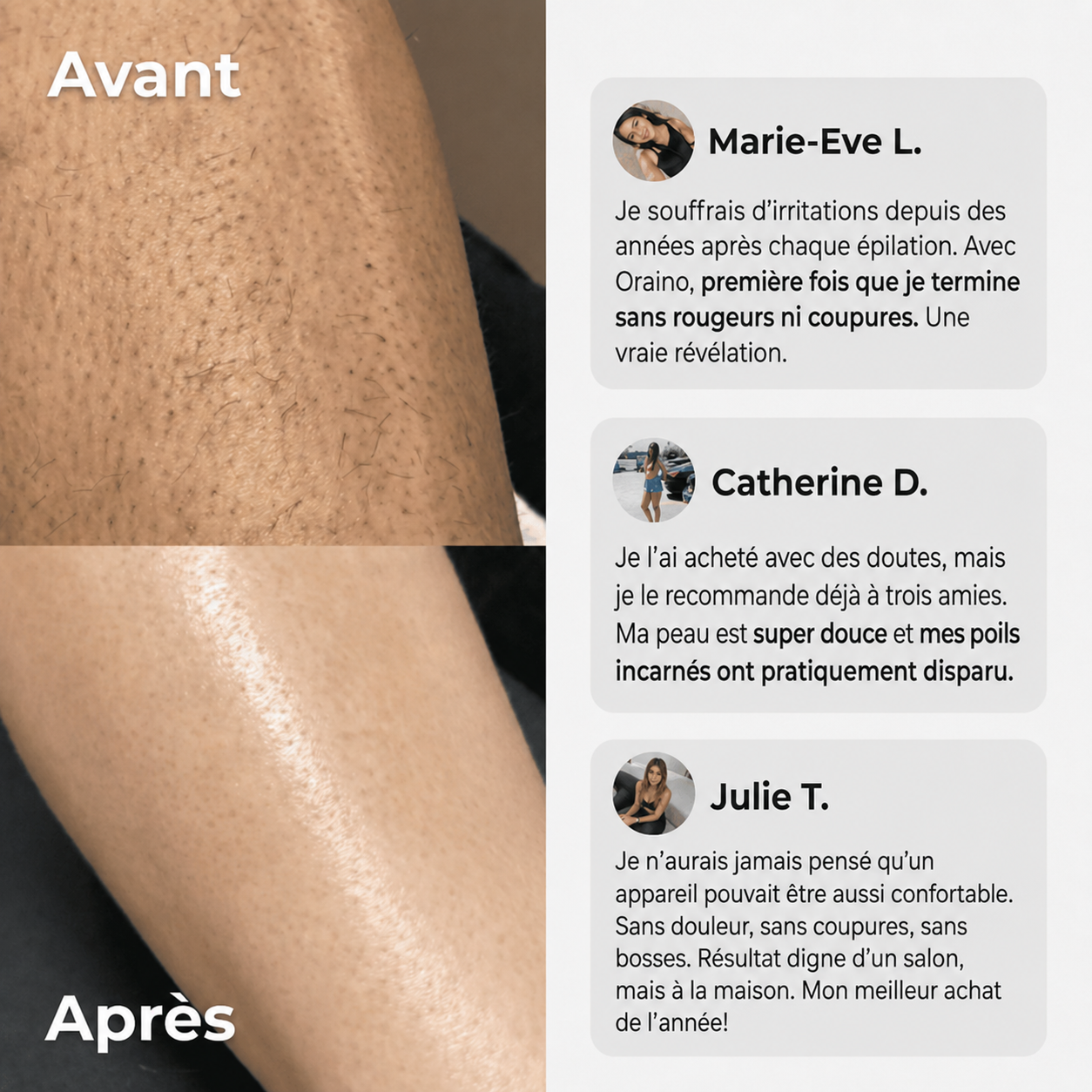 Rasoir 2-en-1 bikini et corps Oraino™