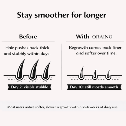 ORAINO Hair Regrowth Inhibitor Serum with Cyperus Oil