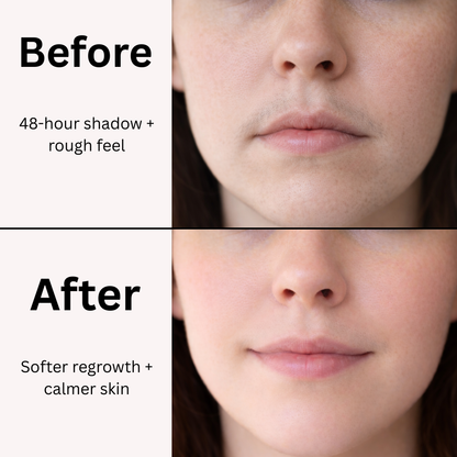 ORAINO Hair Regrowth Inhibitor Serum with Cyperus Oil